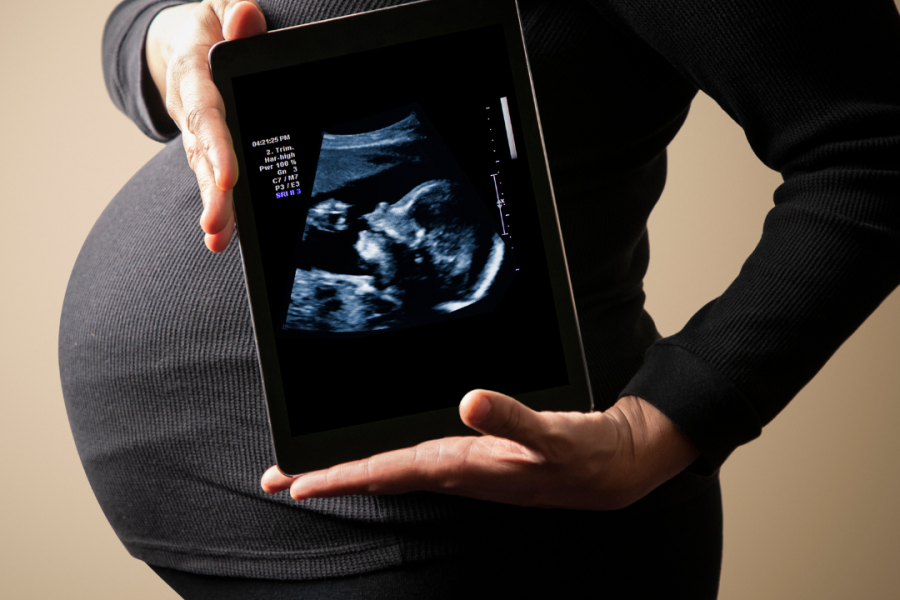 My BABY IS BREECH. What can I do?